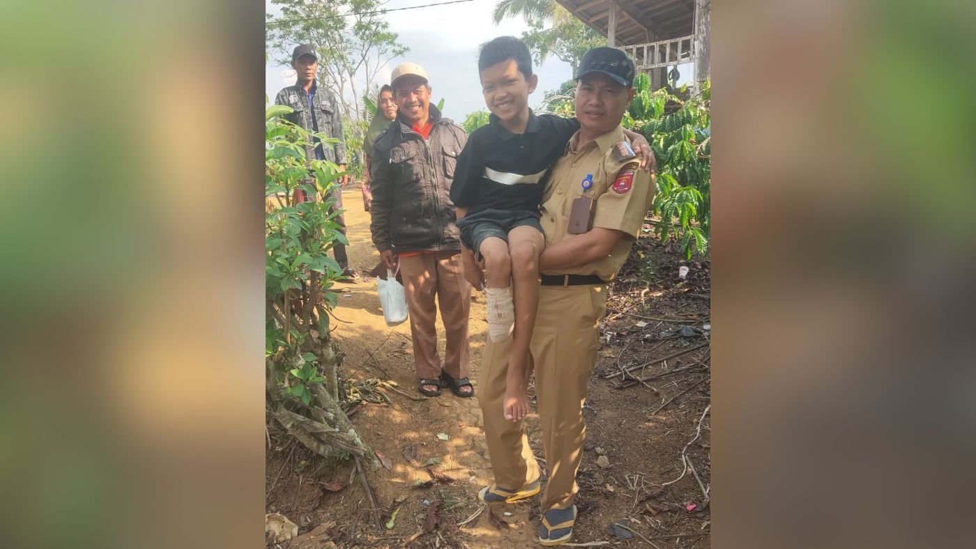 Gunakan Mobil Dinas, Camat Batu Ketulis Bantu Bocah Korban Amputasi Jalani Kontrol